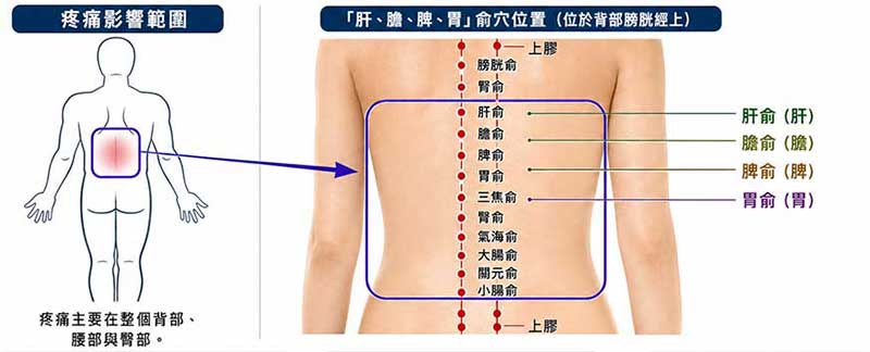 春夏季節最常見的背痛部位