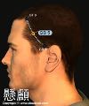 懸顱