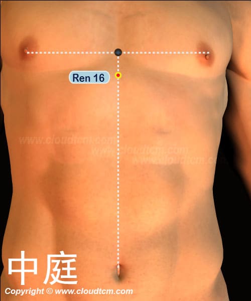 中庭