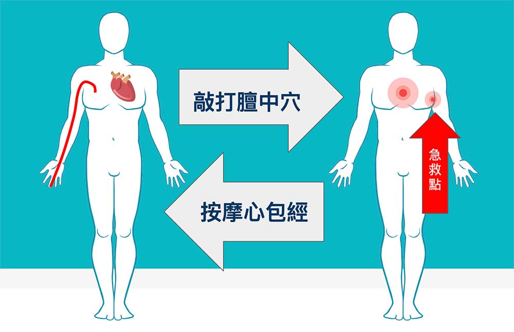 按摩心包經與敲打膻中穴是養生重要動作