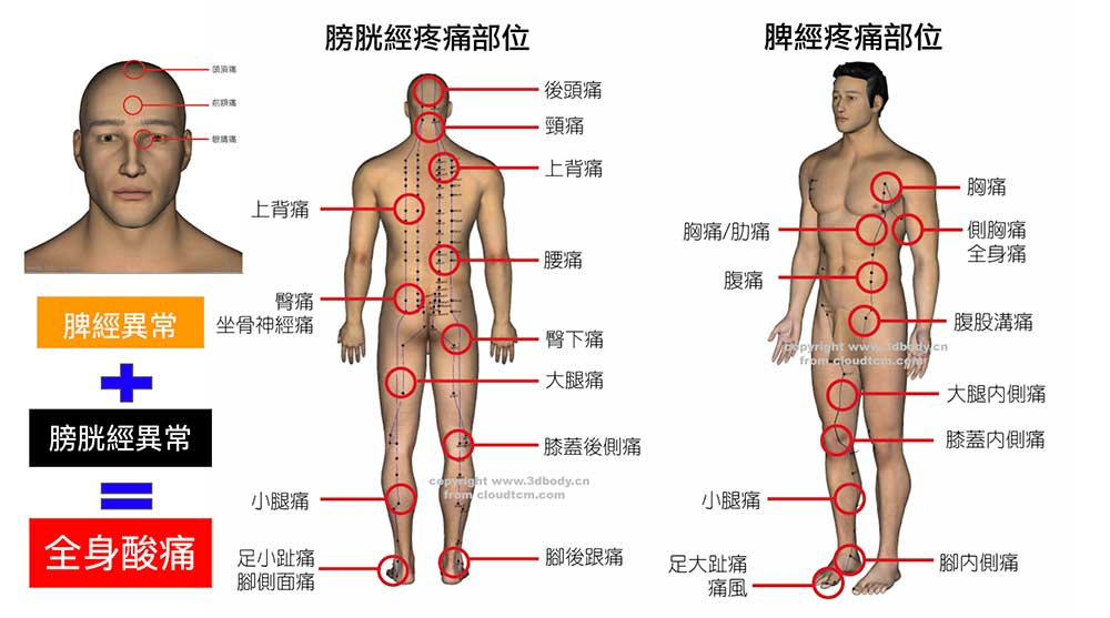 膀胱經陽氣不足,連動脾經出現各種全身痛的現象