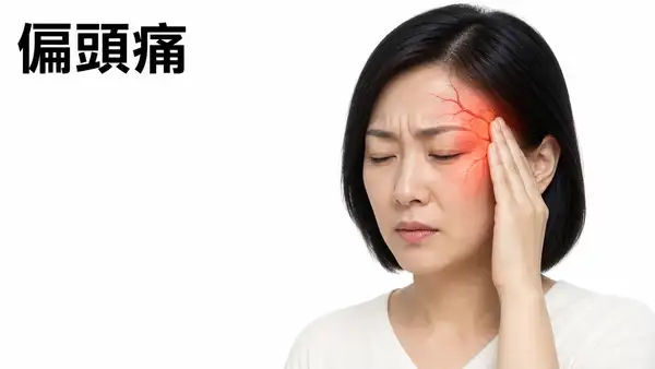 偏頭痛