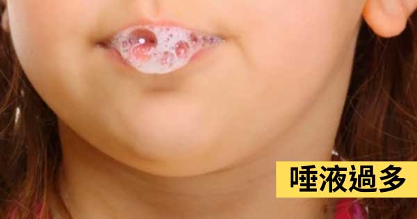 唾液過多