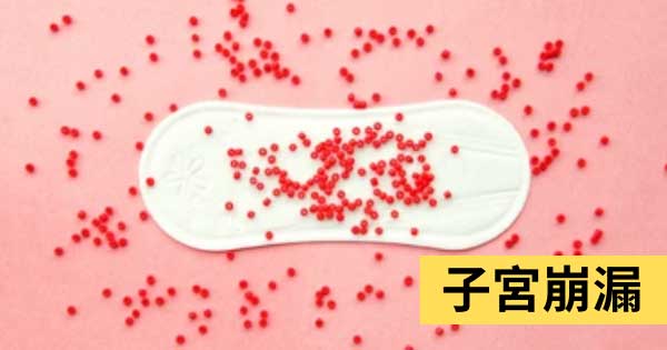 子宮崩漏