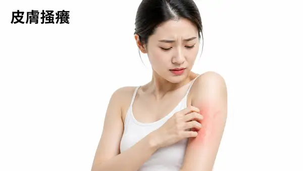 皮膚搔癢