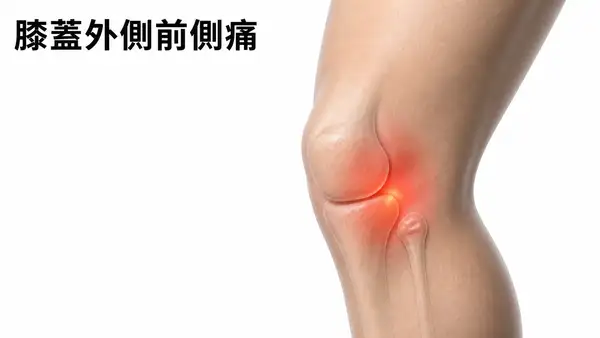 膝蓋外側前側痛