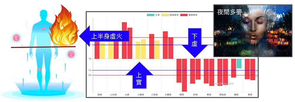 上實下虛的人容易多夢