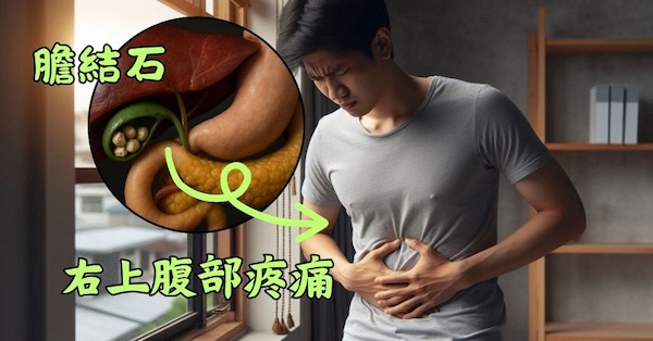 右上腹部劇烈疼痛時，有可能是膽結石