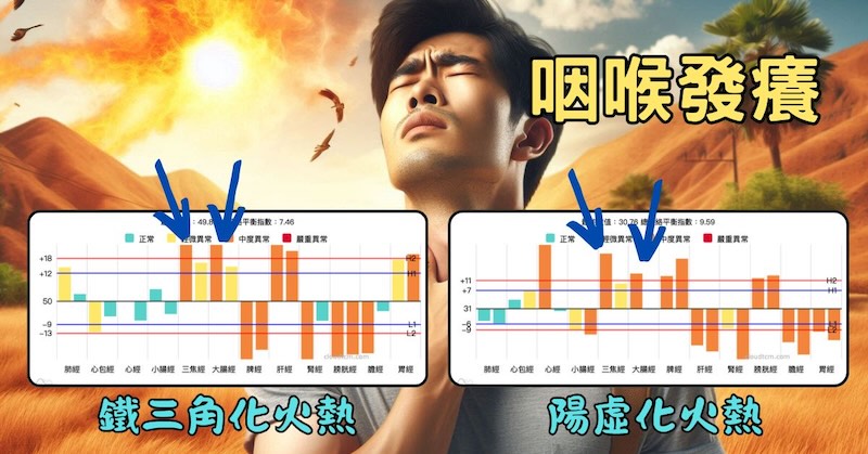 咽喉癢時，體內的經絡型態都是化火熱為主