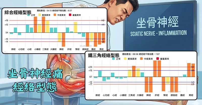 坐骨神經痛常見的經絡型態