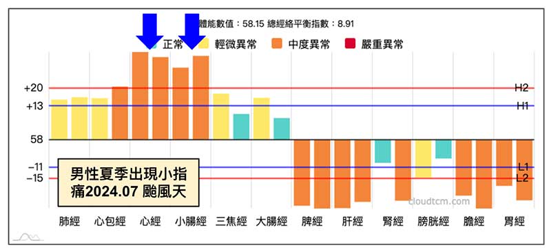 男性在夏季出現小指痛，颱風天檢測出現的經絡現象