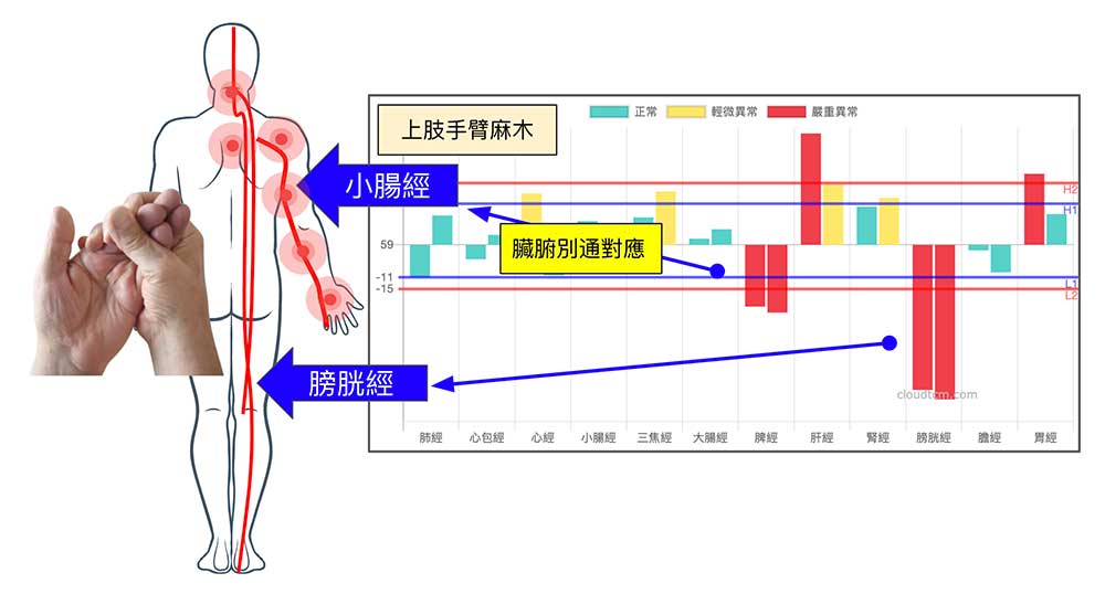 太陽經長期阻塞時，容易出現手麻