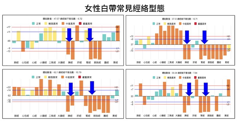 女性出現白帶常見的經絡型態