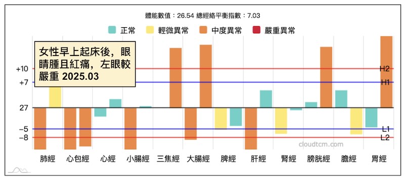 女性在早上起床之後，出現眼睛紅痛現象