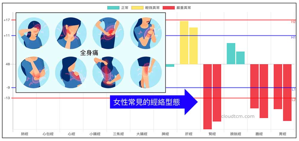 女性容易出現全身痛