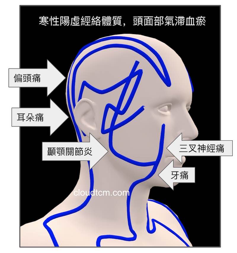 寒性體質的人，頭面部容易出現各種疼痛