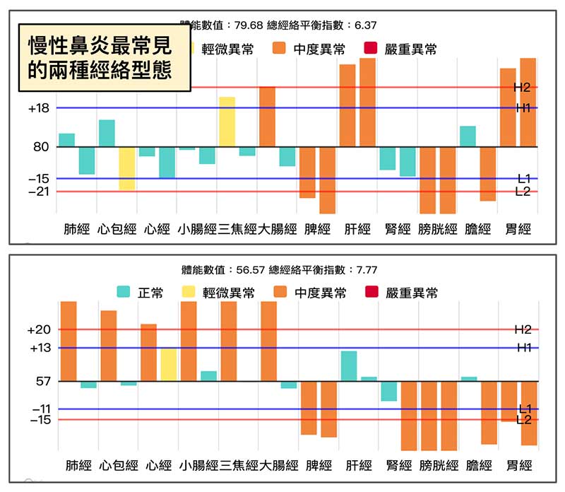 慢性鼻炎最常見的兩種經絡型態
