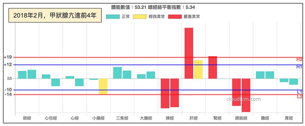 2018年甲狀現亢進確診前4年，出現鐵三角經絡型態