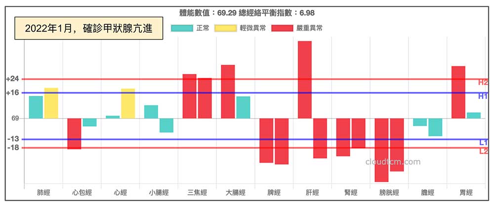 發生在冬季的甲狀腺亢進案例