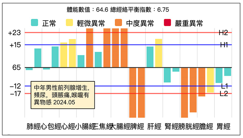 男性前列腺增生，容易頻尿