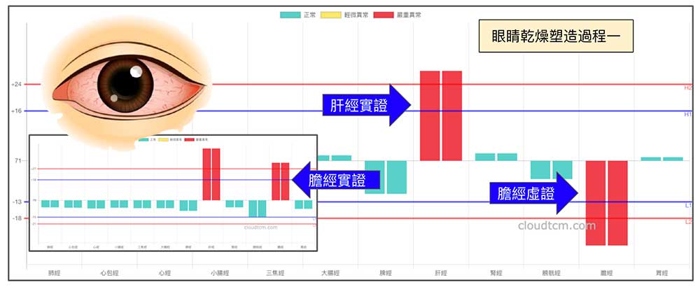 熬夜過度疲勞之後，肝經膽經開始異常