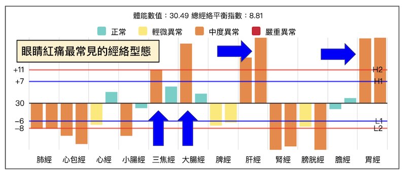 系統中，眼睛紅痛最常見的經絡型態