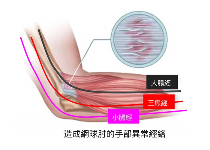 通往手肘外側主要是大腸、三焦與小腸經