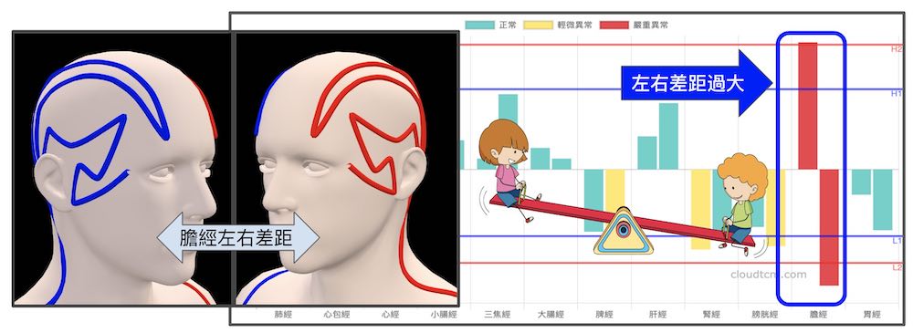 膽經左右能量差距過大，就像翹翹板左右不平衡造成頭暈