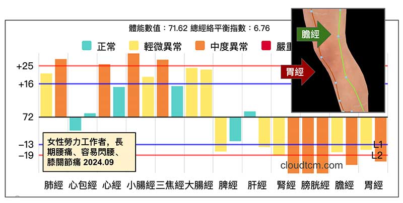 長期在寒濕環境工作，容易閃到腰膝蓋痛的經絡型態