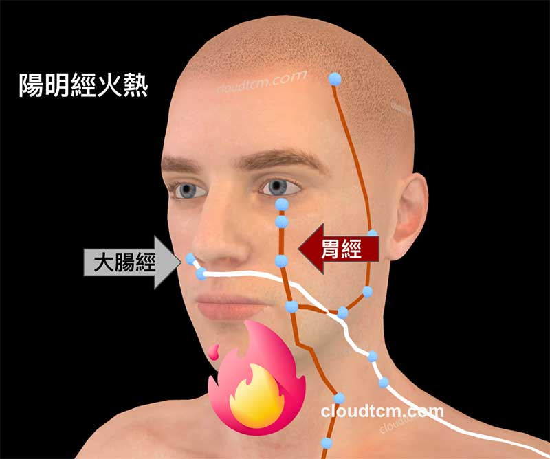 陽明經火熱時，很容易出現鼻子癢