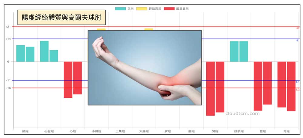 陽虛經絡體質的人，出現的疼痛難以根治