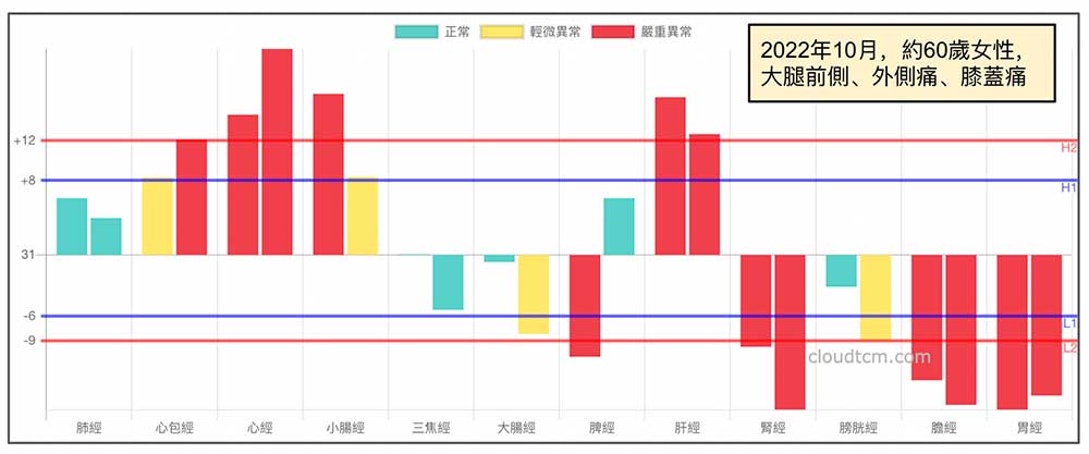 2022年10月60歲女性大腿前側、外側痛、膝蓋痛案例