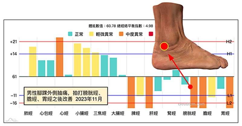 2023年11月之後出現腳踝外側痛