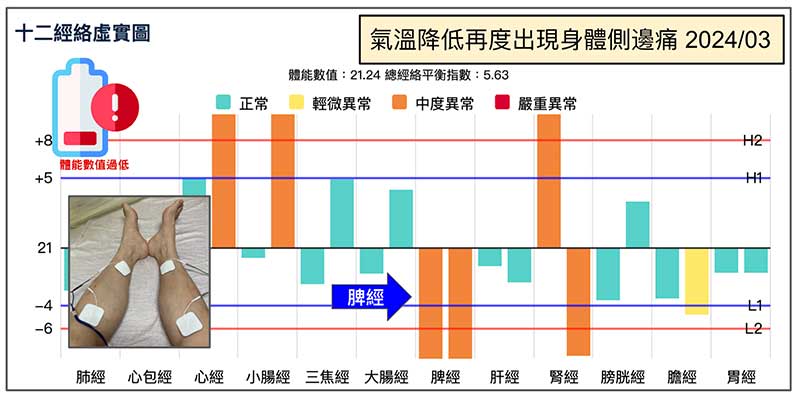 天氣溫度下降之後，再度出現身體側邊痛