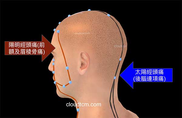 太陽經與陽明經頭痛