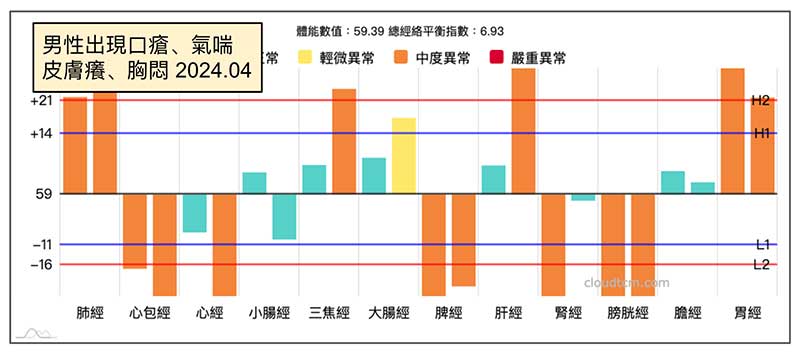 天氣炎熱後開始出現口瘡口角炎案例