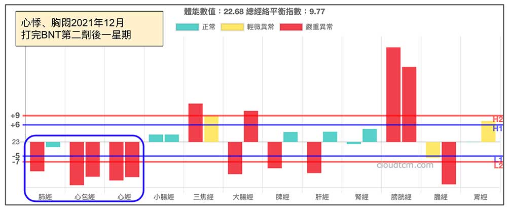 打完第二劑BNT之後一星期，出現類似的經絡現象