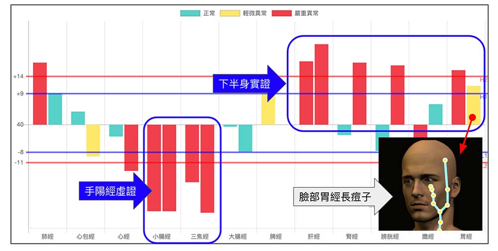 冬天手陽經虛證，下半身實證反而在胃經上長出痘子