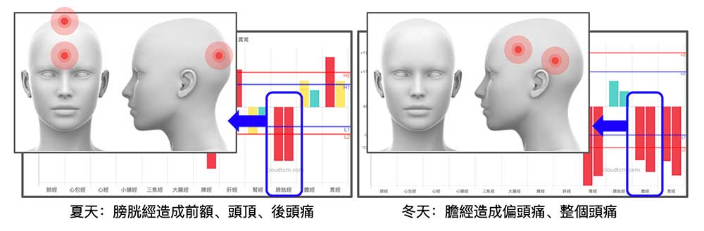 不同的經絡異常,頭痛的位置也不一樣