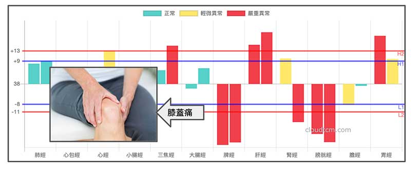 某會員在夏天出現的膝蓋痛經絡圖