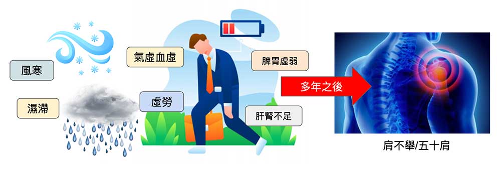 從中醫經絡立場看五十肩，要累積很久的時間才有可能形成