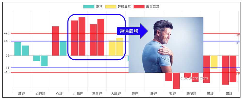 手三陽經絡異常，就容易出現肩膀酸痛