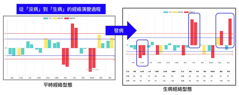 平時沒病與發病的經絡型態類似，個別經絡的不平衡程度加劇