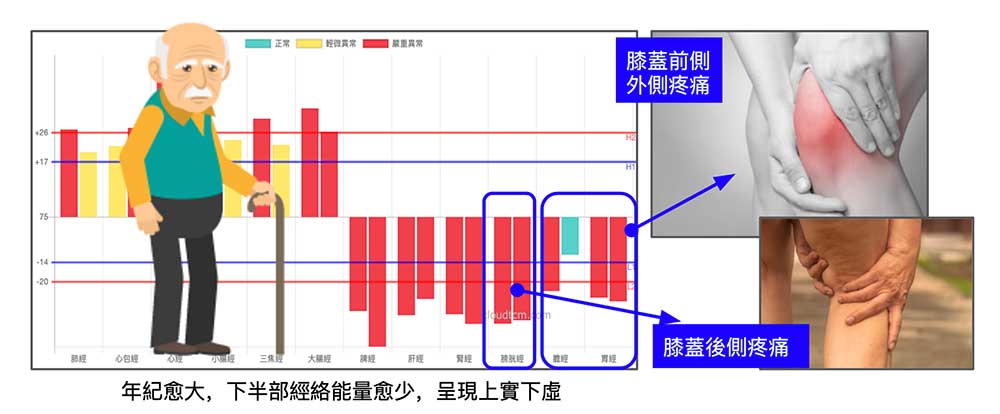 腳部三陽經的阻塞，造成膝蓋前側、外側與後側疼痛