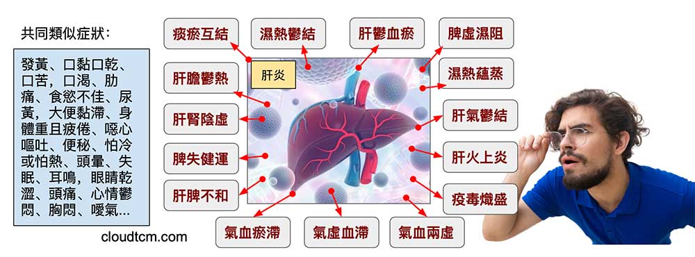 傳統中醫辨證肝炎，證型多到讓人眼花撩亂