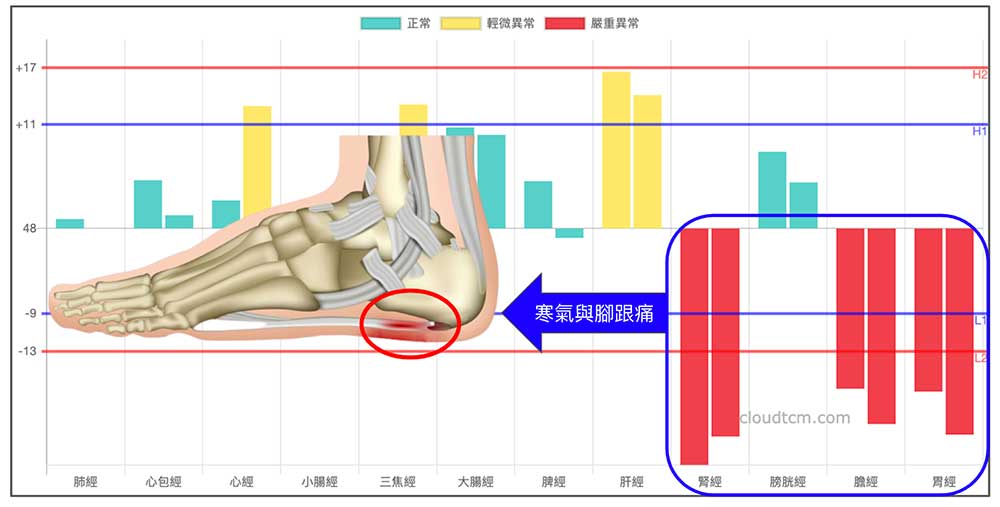 冬天常見的經絡型態,可以清楚看出寒氣與腳跟痛的關係