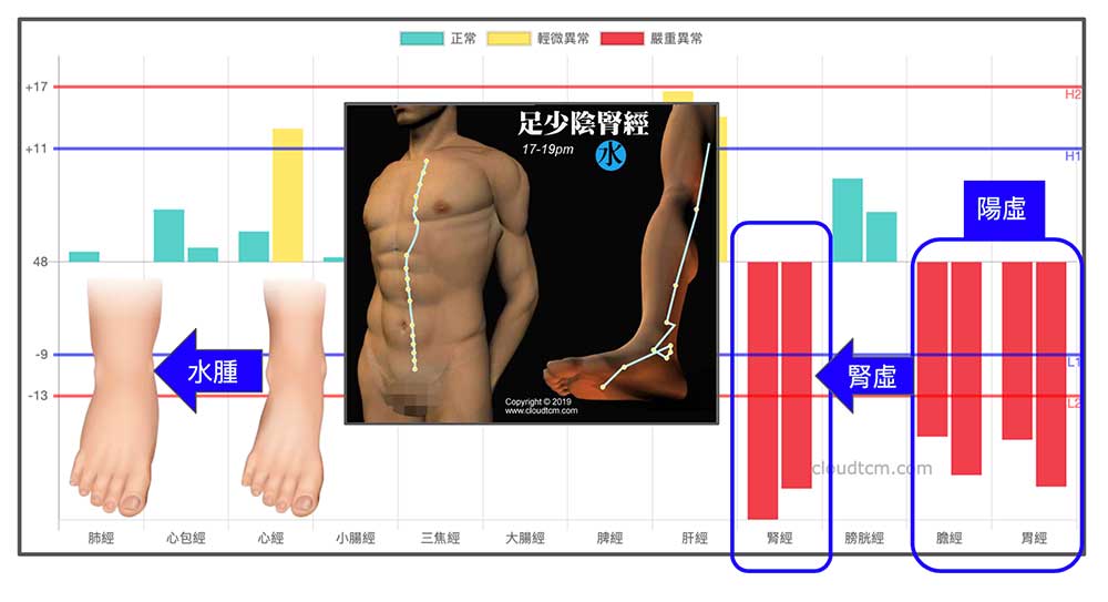 冬天時的常見經絡型態,也容易出現水腫