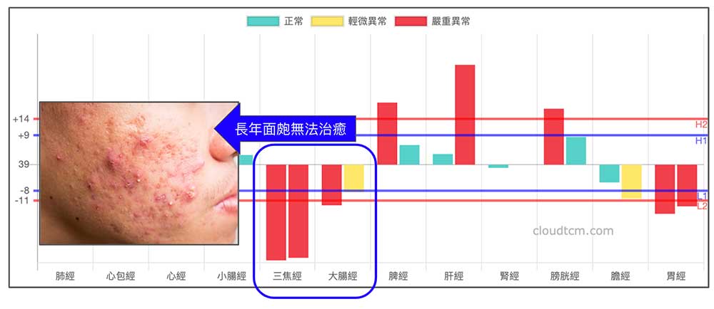 許多長期面皰不癒者，其實是屬於陽虛寒性體質