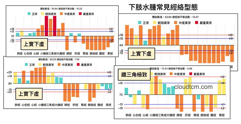 上實下虛經絡型態，很容易出現下肢水腫
