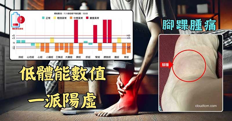 春季容易筋骨受傷的經絡型態，腳腫案例